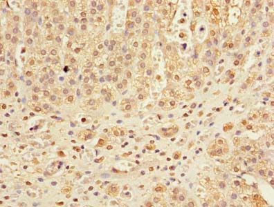 DHX30 Antibody - Immunohistochemistry of paraffin-embedded human adrenal gland tissue using antibody at dilution of 1:100.