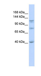 DHX30 Antibody - DHX30 antibody Western blot of MCF7 cell lysate. This image was taken for the unconjugated form of this product. Other forms have not been tested.