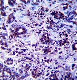 DHX32 Antibody - DHX32 Antibody immunohistochemistry of formalin-fixed and paraffin-embedded human breast tissue followed by peroxidase-conjugated secondary antibody and DAB staining.