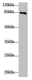 DHX32 Antibody - Western Blot All lanes: DHX32 antibody at 10µg/ml + Mouse liver tissue Secondary Goat polyclonal to rabbit IgG at 1/10000 dilution Predicted band size: 85, 76 kDa Observed band size: 85 kDa