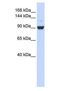 DHX34 Antibody - DHX34 antibody Western Blot of 293T cell lysate.  This image was taken for the unconjugated form of this product. Other forms have not been tested.