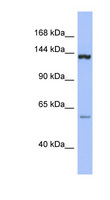 DHX34 Antibody - DHX34 antibody Western blot of THP-1 cell lysate. This image was taken for the unconjugated form of this product. Other forms have not been tested.