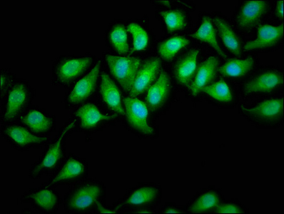 DHX34 Antibody - Immunofluorescence staining of A549 cells at a dilution of 1:166, counter-stained with DAPI. The cells were fixed in 4% formaldehyde, permeabilized using 0.2% Triton X-100 and blocked in 10% normal Goat Serum. The cells were then incubated with the antibody overnight at 4 °C.The secondary antibody was Alexa Fluor 488-congugated AffiniPure Goat Anti-Rabbit IgG (H+L) .