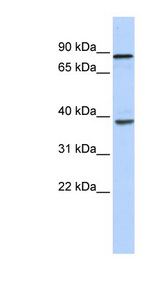 DHX35 Antibody - DHX35 antibody Western blot of Fetal Heart lysate. This image was taken for the unconjugated form of this product. Other forms have not been tested.