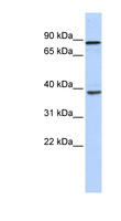 DHX35 Antibody - DHX35 antibody Western blot of Fetal Heart lysate. This image was taken for the unconjugated form of this product. Other forms have not been tested.