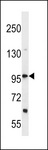 DHX36 Antibody - DHX36 Antibody western blot of HepG2 cell line lysates (35 ug/lane). The DHX36 antibody detected the DHX36 protein (arrow).