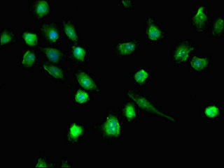 DHX36 Antibody - Immunofluorescent analysis of U251 cells using DHX36 Antibody at dilution of 1:100 and Alexa Fluor 488-congugated AffiniPure Goat Anti-Rabbit IgG(H+L)