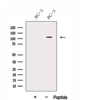 DHX36 Antibody - Western blot analysis of extracts of PC-3 cells using DHX36 antibody. The lane on the left was treated with blocking peptide.