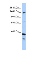 DHX37 Antibody - DHX37 antibody Western blot of MCF7 cell lysate. This image was taken for the unconjugated form of this product. Other forms have not been tested.