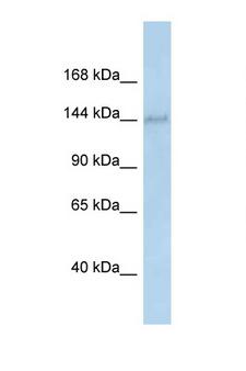 DHX38 Antibody - DHX38 antibody Western blot of Rat Brain lysate. Antibody concentration 1 ug/ml.  This image was taken for the unconjugated form of this product. Other forms have not been tested.