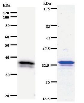 DHX38 Antibody - Western blot of immunized recombinant protein using DHX38 antibody. Left: DHX38 staining. Right: Coomassie Blue staining of immunized recombinant protein.