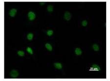 DHX38 Antibody - Immunofluorescent staining using DHX38 antibody. Immunostaining analysis in HeLa cells. HeLa cells were fixed with 4% paraformaldehyde and permeabilized with 0.01% Triton-X100 in PBS. The cells were immunostained with anti-DHX38 antibody.