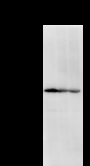 DHX38 Antibody - Detection of DHX38 by Western blot. Samples: Whole cell lysate from human HeLa (H, 50 ug) , mouse NIH3T3 (M, 50 ug) and rat F2408 (R, 50 ug) cells. Predicted molecular weight: 140 kDa