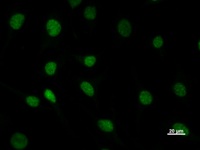 DHX38 Antibody - Immunostaining analysis in HeLa cells. HeLa cells were fixed with 4% paraformaldehyde and permeabilized with 0.1% Triton X-100 in PBS. The cells were immunostained with anti-DHX38 mAb.