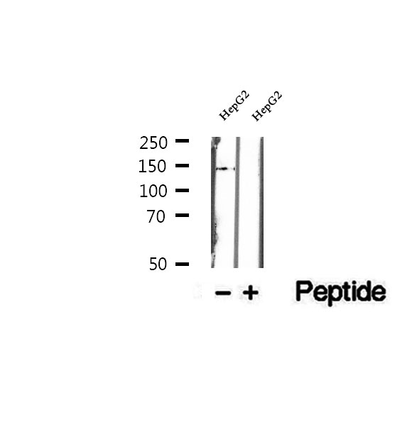 DHX38 Antibody - Western blot analysis of extracts of HepG2 cells using DHX38 antibody.