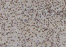 DHX38 Antibody - 1:100 staining human liver tissue by IHC-P. The sample was formaldehyde fixed and a heat mediated antigen retrieval step in citrate buffer was performed. The sample was then blocked and incubated with the antibody for 1.5 hours at 22°C. An HRP conjugated goat anti-rabbit antibody was used as the secondary.