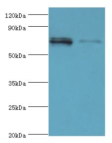 DHX58 / LGP2 Antibody - Western blot. All lanes: DHX58 antibody at 12 ug/ml. Lane 1: 293T whole cell lysate. Lane 2: Rat kidney tissue. Secondary antibody: Goat polyclonal to rabbit at 1:10000 dilution. Predicted band size: 77 kDa. Observed band size: 77 kDa.