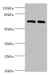 DHX58 / LGP2 Antibody - Western blot All lanes: DHX58 antibody at 12µg/ml Lane 1: 293T whole cell lysate Lane 2: Rat kidney tissue Secondary Goat polyclonal to rabbit IgG at 1/10000 dilution Predicted band size: 77 kDa Observed band size: 77 kDa