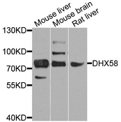 DHX58 / LGP2 Antibody - Western blot analysis of extract of various cells.