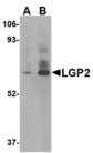 DHX58 / LGP2 Antibody - Western blot of LGP2 in rat kidney tissue lysate with LGP2 antibody at (A) 1 and (B) 2 ug/ml.