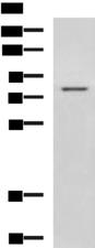 DHX58 / LGP2 Antibody - Western blot analysis of Rat liver tissue lysate  using DHX58 Polyclonal Antibody at dilution of 1:800
