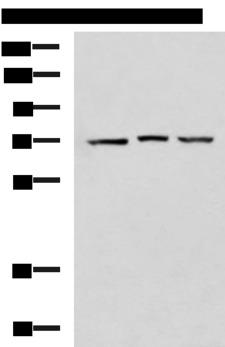 DHX58 / LGP2 Antibody - Western blot analysis of 293T cell lysates  using DHX58 Polyclonal Antibody at dilution of 1:900
