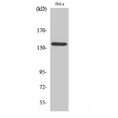 DHX8 Antibody - Western blot of DDX8 antibody