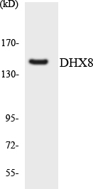 DHX8 Antibody - Western blot analysis of the lysates from HeLa cells using DHX8 antibody.