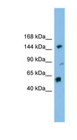 DHX8 Antibody - DHX8 antibody Western blot of HT1080 cell lysate. This image was taken for the unconjugated form of this product. Other forms have not been tested.