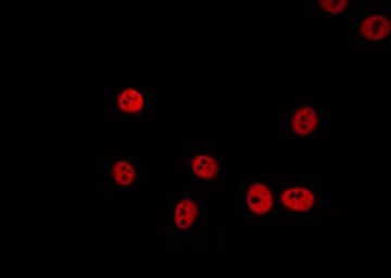 DHX8 Antibody - Staining HeLa cells by IF/ICC. The samples were fixed with PFA and permeabilized in 0.1% Triton X-100, then blocked in 10% serum for 45 min at 25°C. The primary antibody was diluted at 1:200 and incubated with the sample for 1 hour at 37°C. An Alexa Fluor 594 conjugated goat anti-rabbit IgG (H+L) Ab, diluted at 1/600, was used as the secondary antibody.