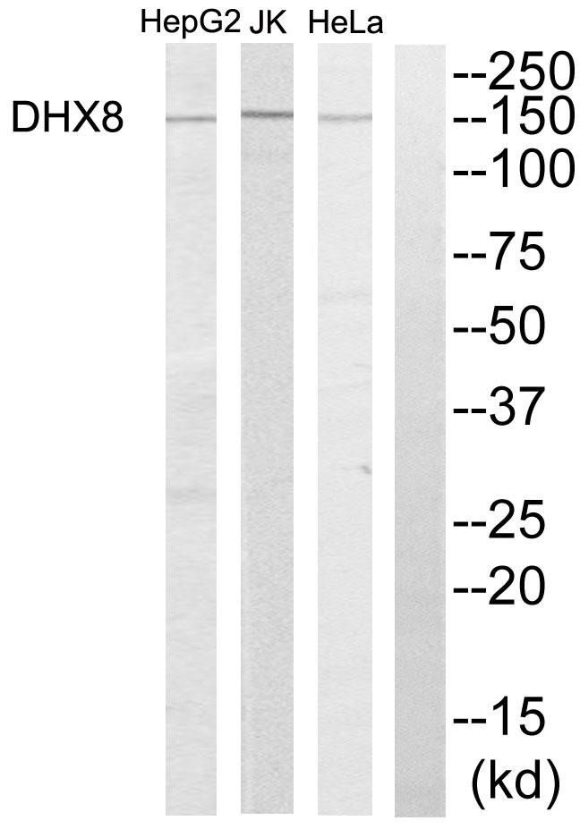 DHX8 Antibody - Western blot analysis of extracts from HeLa cells, Jurkat cells and HepG2 cells, using DHX8 antibody.