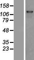 DHX8 Protein - Western validation with an anti-DDK antibody * L: Control HEK293 lysate R: Over-expression lysate