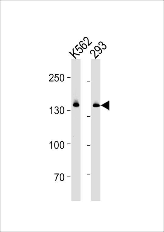 DHX9 Antibody - DHX9 Antibody western blot of K562 and 293 cell line lysates (35 ug/lane). The DHX9 antibody detected the DHX9 protein (arrow).