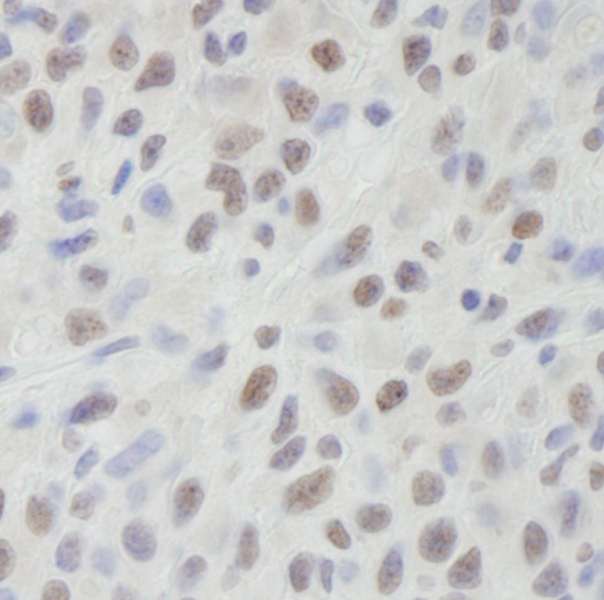 DHX9 Antibody - Detection of Mouse DHX9 by Immunohistochemistry. Sample: FFPE section of mouse squamous cell carcinoma. Antibody: Affinity purified rabbit anti-DHX9 used at a dilution of 1:250.