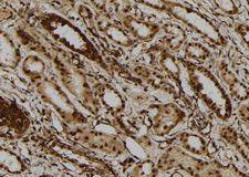 DHX9 Antibody - 1:100 staining human kidney tissue by IHC-P. The sample was formaldehyde fixed and a heat mediated antigen retrieval step in citrate buffer was performed. The sample was then blocked and incubated with the antibody for 1.5 hours at 22°C. An HRP conjugated goat anti-rabbit antibody was used as the secondary.