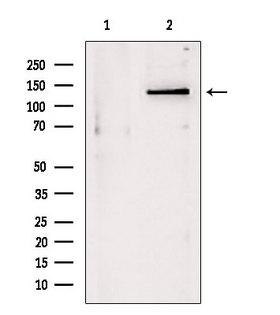 DHX9 Antibody - Western blot analysis of extracts of mouse myeloma using DHX9 antibody. Lane 1 was treated with the blocking peptide.