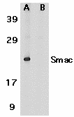 DIABLO / SMAC Antibody - Western blot analysis of Smac in human heart tissue lysate in the absence (A) or presence (B) of blocking peptide with Smac antibody at 1µg/ml.