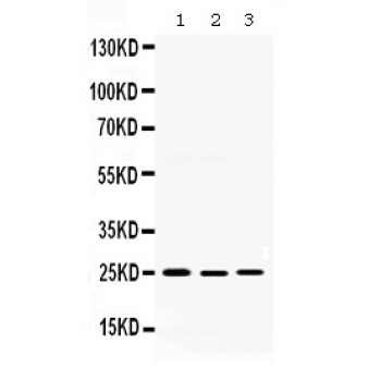 DIABLO / SMAC Antibody - Western blot analysis of Smac/Diablo expression in rat testis extract (lane 1), 22RV1 whole cell lysates (lane 2) and SKOV whole cell lysates (lane 3). Smac/Diablo at 25 kD was detected using rabbit anti- Smac/Diablo Antigen Affinity purified polyclonal antibody at 0.5 ug/mL. The blot was developed using chemiluminescence (ECL) method.