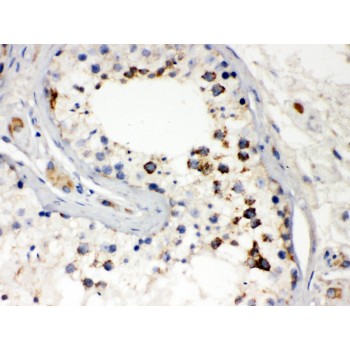 DIABLO / SMAC Antibody - Smac/Diablo was detected in paraffin-embedded sections of human testis tissues using rabbit anti- Smac/Diablo Antigen Affinity purified polyclonal antibody at 1 ug/mL. The immunohistochemical section was developed using SABC method.