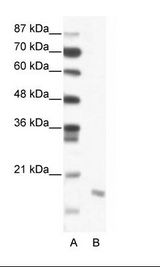 DIABLO / SMAC Antibody - A: Marker, B: Jurkat Cell Lysate.  This image was taken for the unconjugated form of this product. Other forms have not been tested.