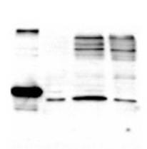 DIABLO / SMAC Antibody - Western blot of anti-Smac detects a 26 kD band when 1 ug of recombinant Smac is applied (lane 1). Lane 2 shows Smac detection when 30 ug of 1% NP-40 treated cell lysate from HeLa cells is applied. Lanes 3 & 4 show 30 ug each of cytosolic fractions from HeLa cell lysates both with (lane 3) and without (lane 4) treatment with 30 uM etoposide. Recombinant Smac migrates slower than the native form because of the His6-tag. Antibody was used at a 1:1000 dilution.