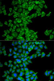 DIABLO / SMAC Antibody - Immunofluorescence analysis of MCF-7 cells.