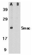 DIABLO / SMAC Antibody - Western blot of Smac in human heart tissue lysate in the absence (A) or presence (B) of blocking peptide (2409P) with Smac antibody at 1 ug/ml.