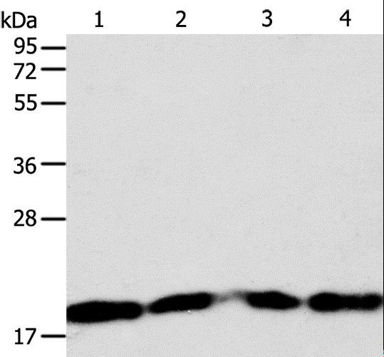 DIABLO / SMAC Antibody - Western blot analysis of LNCaP, SKOV3, MCF7 and 293T cell, using DIABLO Polyclonal Antibody at dilution of 1:1000.