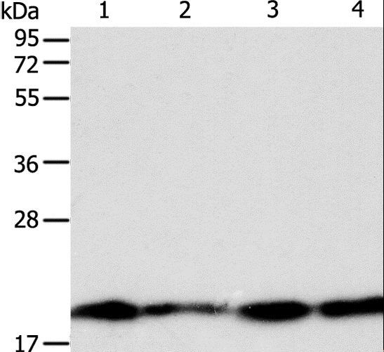 DIABLO / SMAC Antibody - Western blot analysis of LNCaP, SKOV3, MCF7 and 293T cell, using DIABLO Polyclonal Antibody at dilution of 1:800.