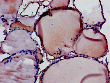 DIABLO / SMAC Antibody - Immunohistochemistry image of paraffin-embedded human thyroid tissue at a dilution of 1:100