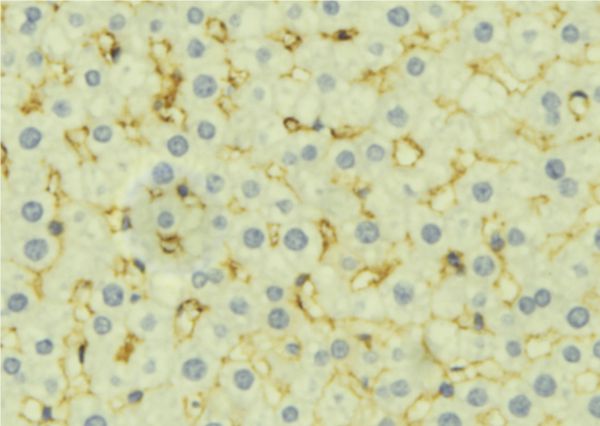 DIABLO / SMAC Antibody - 1:100 staining mouse liver tissue by IHC-P. The sample was formaldehyde fixed and a heat mediated antigen retrieval step in citrate buffer was performed. The sample was then blocked and incubated with the antibody for 1.5 hours at 22°C. An HRP conjugated goat anti-rabbit antibody was used as the secondary.