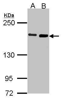 DIAPH1 Antibody - Sample (30 ug of whole cell lysate). A: H1299, B: Raji. 7.5% SDS PAGE. DIAPH1 antibody diluted at 1:1000.