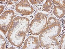 DIAPH1 Antibody - IHC of paraffin-embedded gastric tissue using DIAPH1 antibody at 1:100 dilution.