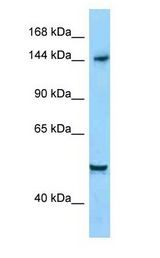 DIAPH1 Antibody - DIAPH1 antibody Western Blot of HepG2.  This image was taken for the unconjugated form of this product. Other forms have not been tested.